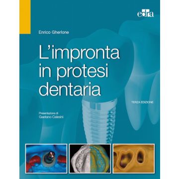 Gherlone L'impronta in protesi dentaria 2017