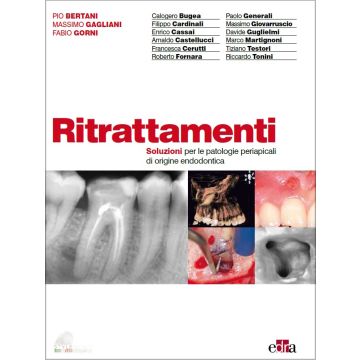 Ritrattamenti Soluzioni per le patologie apicali di origine endodontica Bertani Gagliani Gorni Edra