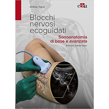 Blocchi nervosi ecoguidati - Sonoanatomia di base e avanzata   [Tognù - Edra Masson]