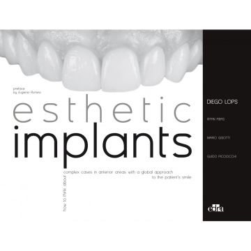Esthetic implants. How to think about complex cases in anterior areas with a global approach to the patient' s smile