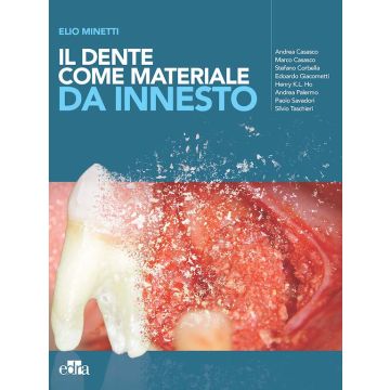 Il dente come materiale da innesto Minetti Elio Casasco Andrea Corbella Stefano edra