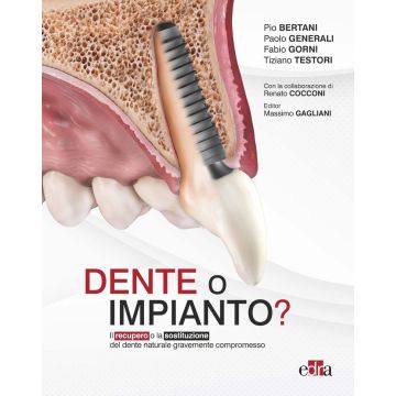 Dente o impianto? Il recupero o la sostituzione del dente naturale gravemente compromesso [Bertani Pio; Generali Paolo; Gorni Fabio - Edra Masson]