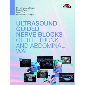Ultrasound guided nerve blocks of the trunk and abdominal wall