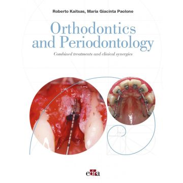 Orthodontics and Periodontology. Combined treatments and clinical synergies