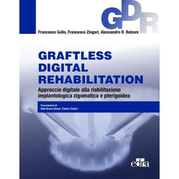 Graftless digital rehabilitatio, GDR. Approccio digitale alla riabilitazione implantologica zigomatica e pterigoidea. Con QR Code [Gallo Francesco; Zingari; Bolzoni - Edra Masson]