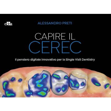 Capire il CEREC. Il pensiero digitale innovativo per la Single Visit Dentistry
