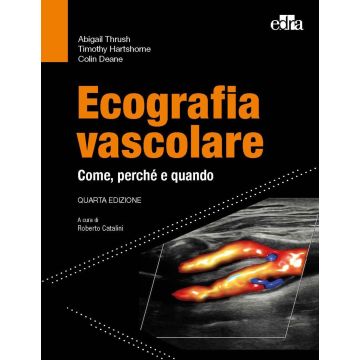 Ecografia vascolare. Come, perché e quando
