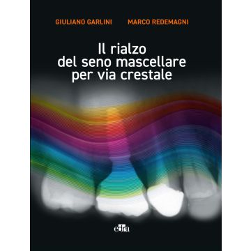 Il rialzo del seno mascellare per via crestale [Garlini Giuliano; Redemagni Marco - Edra Masson]