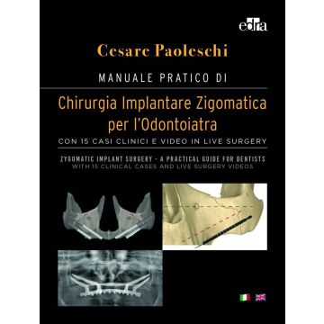 Manuale pratico di Chirurgia Implantare Zigomatica per l'odontoiatra. Con 15 casi clinici e video in live surgery - Zygomatic implant surgery. A practical guide for dentist. With 15 clinical cases and live surgery videos. Ediz. Con DVD video