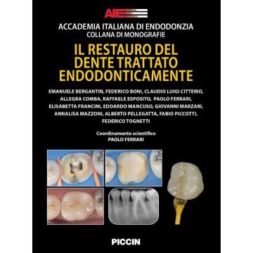 Il restauro del dente trattato endodonticamente (AIE, Ambu, Bellucci, Rovai - Piccin)