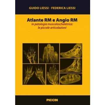 Atlante Rm e Angio Rm in patologia muscoloscheletrica: le piccole articolazioni  Liessi Guido; Liessi Federica  Piccin Editore  9788829927791
