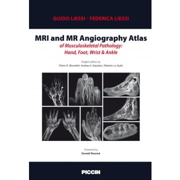 MRI and MR Angiography Atlas of Musculoskeletal Pathology: Hand, Foot, Wrist & Ankle   [Biondetti - Piccin Editore]