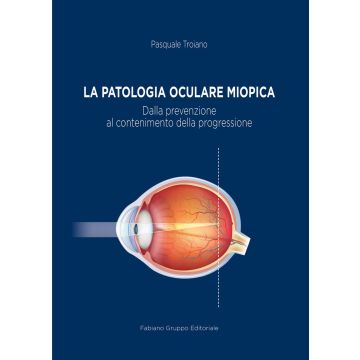 La patologia oculare miopica dalla prevenzione al contenimento della progressione pasquale troiano fabiano editore
