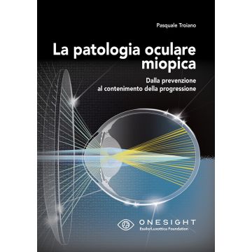 La patologia oculare miopica. Dalla prevenzione al contenimento della progressione. Ediz. per la scuola