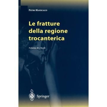 Le fratture della regione trocanterica (Maniscalco Pietro - Springer)
