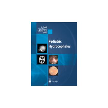 Pediatric Hydrocephalus - Cinalli G. ; Maixner W. J. ; Sainte-rose C.  - Springer Verlag Italia - 9788847002258