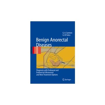 Benign Anorectal Diseases: Diagnosis With Endoanal And Endorectal  Ultrasonography And New Treatment Options - Santoro Giulio A.; Di Falco Giuseppe - Springer Verlag Italia - 9788847003361