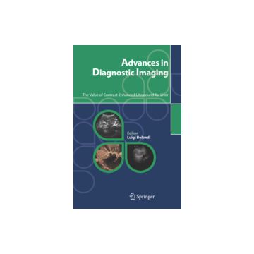 Advances In Diagnostic Imaging. The Value Of Contrast-enhanced Ultrasound For  Liver - Correas Jean-michel; Lencioni Riccardo; Weskott Hans P.; Bolondi L.  - Springer Verlag Italia - 9788847004573