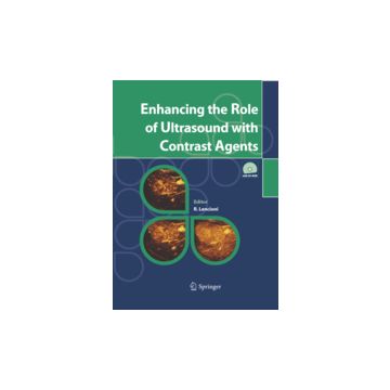 Enhancing The Role Of Ultrasound With Contrast Agents - Lencioni R.  - Springer Verlag Italia - 9788847004757