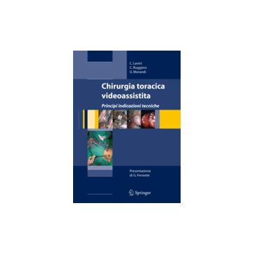 Chirurgia Toracica Videoassistita - Lavini Corrado; Ruggiero Ciro; Morandi Uliano - Springer Verlag Italia - 9788847005228