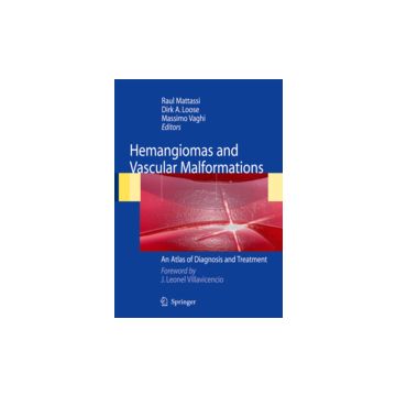 Hemangiomas And Vascular Malformations. An Atlas Of Diagnosis And Treatment -  - Springer Verlag Italia - 9788847005693