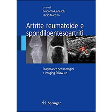 Artrite Reumatoide e Spondiloentesoartriti. Diagnostica per immagini ed imaging follow-up