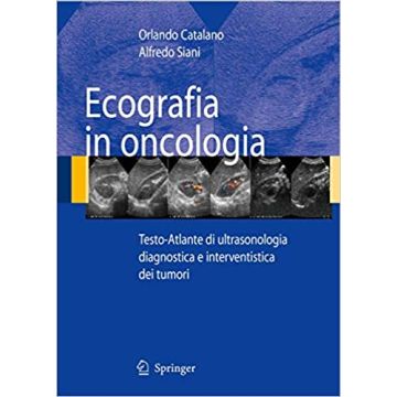 Ecografia in oncologia. Testo-Atlante di ultrasonologia diagnostica e interventistica dei tumori + CD ROM