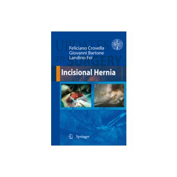 Incisional Hernia - Crovella Feliciano; Bartone Giovanni; Fei Landino - Springer Verlag Italia - 9788847007215