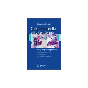 Carcinoma Della Cervice Uterina. Eziopatogesi E Profilassi - Broccolo Francesco - Springer Verlag Italia - 9788847008519
