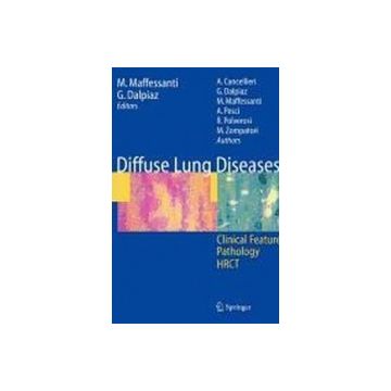 Diffuse Lung Diseases. Clinical Features, Phatology, Hrct -  - Springer Verlag Italia - 9788847009448