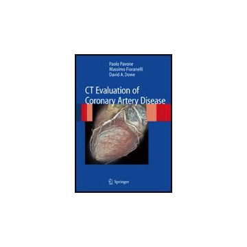 Ct Evaluation Of Coronary Artery Disease - Pavone Paolo; Fioranelli Massimo; Dowe David A. - Springer Verlag Italia - 9788847011250