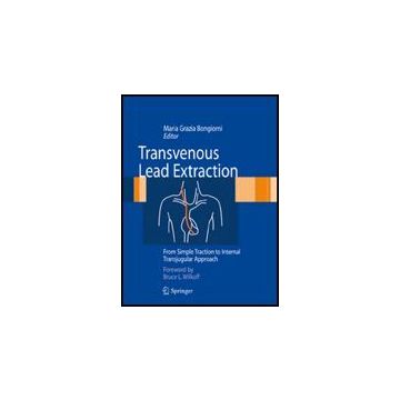 Transvenous Lead Extraction From Simple Traction To Transjugular Approach - Bongiorni M. G.  - Springer Verlag Italia - 9788847014657