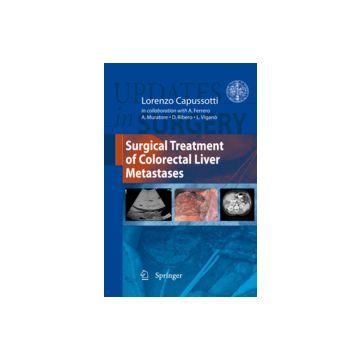 Surgical Treatment Of Colorectal Liver Metastases - Ferrero Alessandro; Muratore Andrea; Ribero Dario; Capussotti L.  - Springer Verlag Italia - 9788847018082