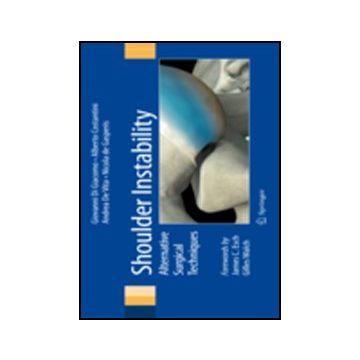Shoulder Instability. Alternative Surgical Techniques -  - Springer Verlag Italia - 9788847020344