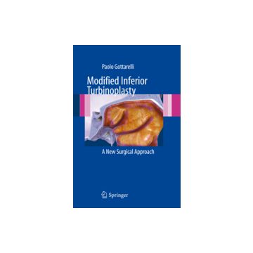 Modified Inferior Turbinoplasty. A New Surgical Approach - Gottarelli Paolo - Springer Verlag Italia - 9788847024410