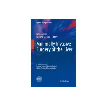 Minimally Invasive Surgery Of The Liver. Con Dvd - Calise F. ; Casciola L.  - Springer Verlag Italia - 9788847026636