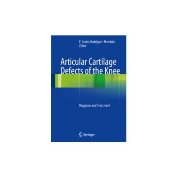 Articular Cartilage Defects Of The Knee - Rodriguez Merchan E. C.  - Springer Verlag Italia - 9788847027268