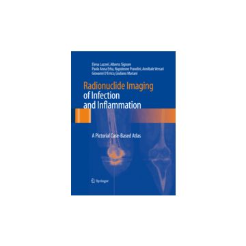 Radionuclide Imaging Of Infection And Inflammation -  - Springer Verlag Italia - 9788847027626