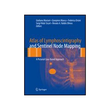 Atlas Of Lymphoscintigraphy And Sentinel Node Mapping. A Pictorial Case-based  Approach -  - Springer Verlag Italia - 9788847027657