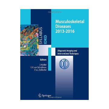 Musculoskeletal Diseases 2013-2016 -  - Springer Verlag Italia - 9788847052918