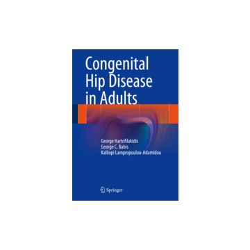 Congenital Hip Disease In Adults - Hartofilakidis George; Babis George C.; Lampropoulou-adamidou Kalliopi - Springer Verlag Italia - 9788847054912
