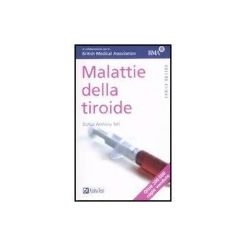 Malattie Della Tiroide