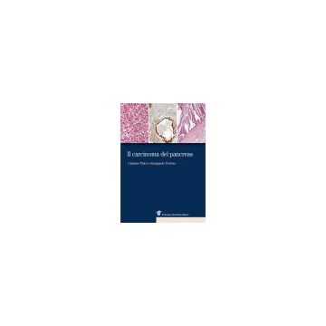 Il carcinoma del pancreas