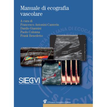 Manuale di Ecografia Vascolare [SIECVI , Antonini Canterin, Giannini - Il Pensiero Scientifico]