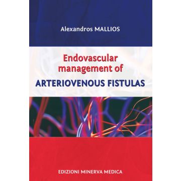 Endovascular management of arteriovenous fistulas