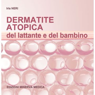 Dermatite atopica del lattante e del bambino