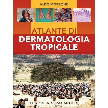 Atlante di dermatologia tropicale