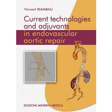 Current technologies and adjuvants in endovascular aortic repair