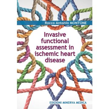 Invasive functional assessment in ischemic heart disease