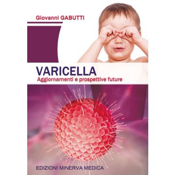 Varicella aggiornamenti e prospettive future gabutti minerva medica